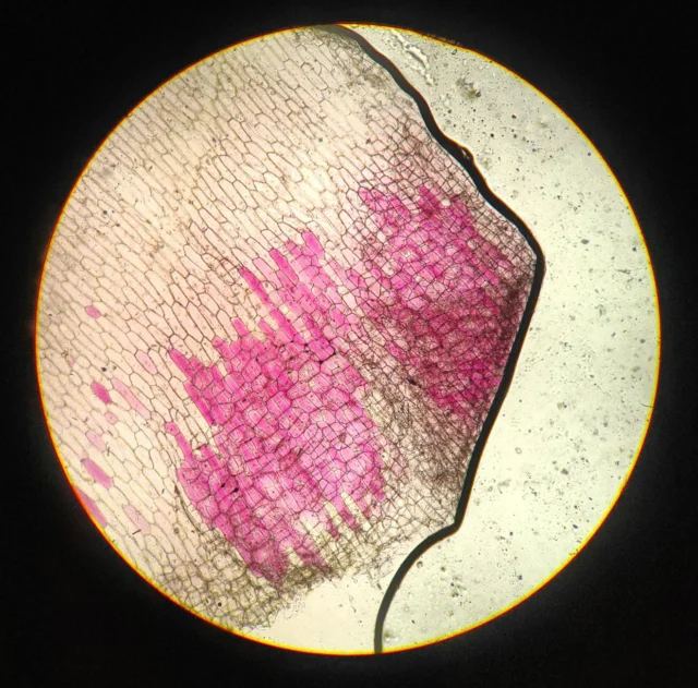 Microscopic view of neural connections illustrating adult brain neuroplasticity