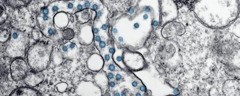 Vaccine training the immune system through molecular recognition and cellular activation