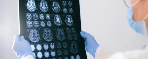 Blood-brain barrier illustration showing brain protection mechanisms