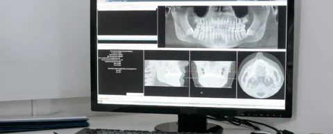Radiologist examining deepfake medical images on a diagnostic screen
