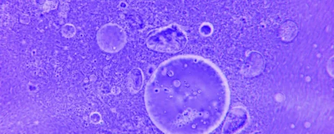 Microscopic view of immune cells illustrating immunological memory mechanisms