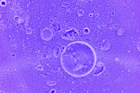 How the Immune System Learns: T-Cells, B-Cells, and the Memory of Infection